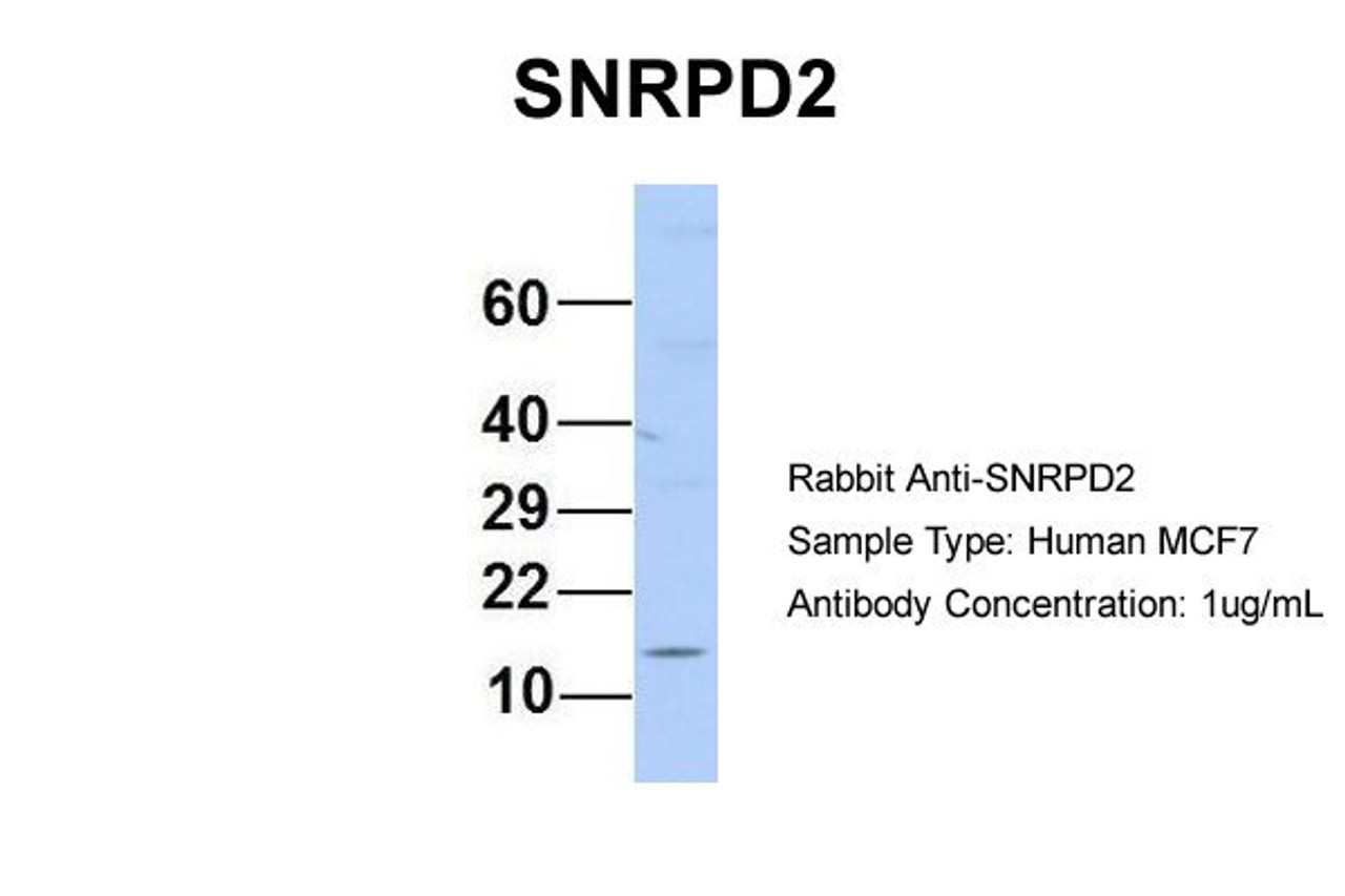 Antibody used in WB on Human MCF7 at 1 ug/ml.