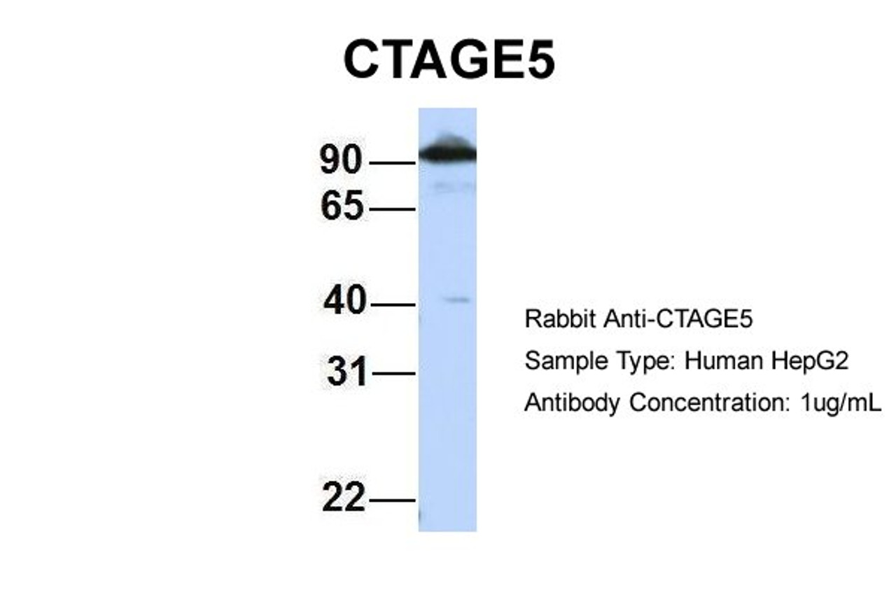 Antibody used in WB on Human HepG2 cells at 1 ug/ml.