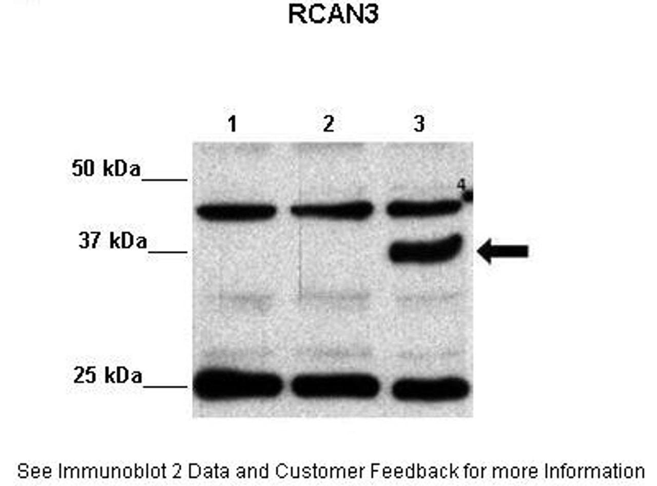 Antibody used in WB on transfected HEK293.