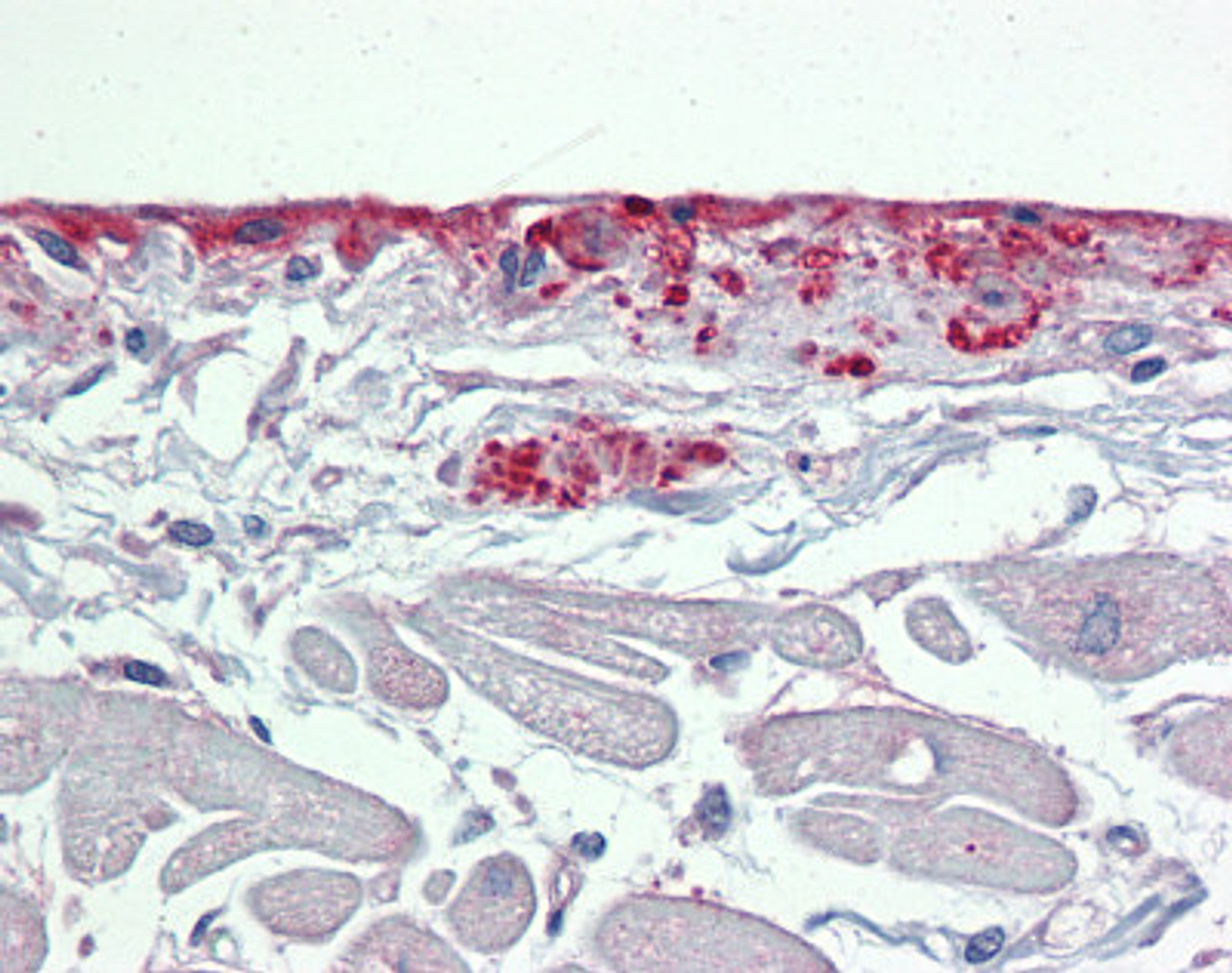 Antibody used in IHC on Human Heart at 5 ug/ml.