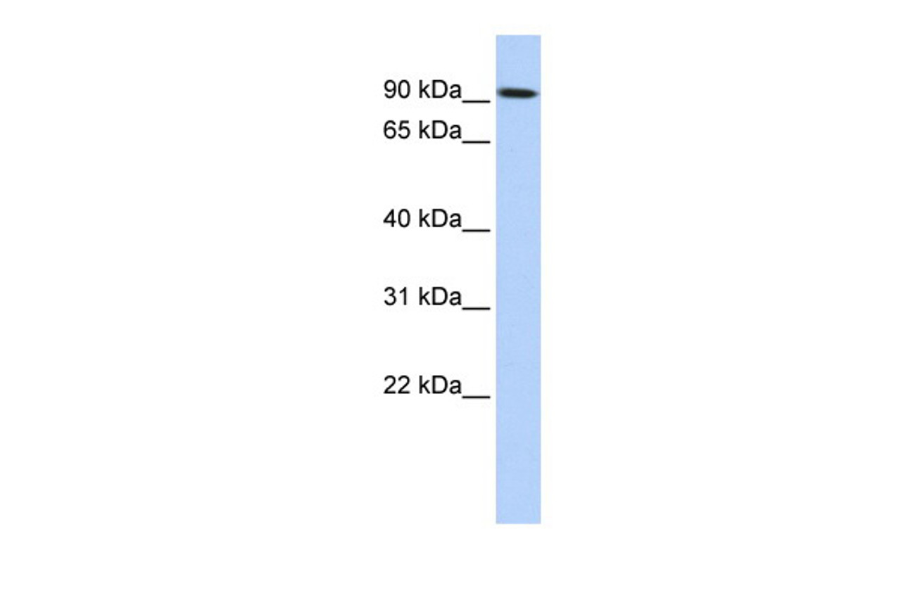 Antibody used in WB on Transfected 293T at 0.2-1 ug/ml.