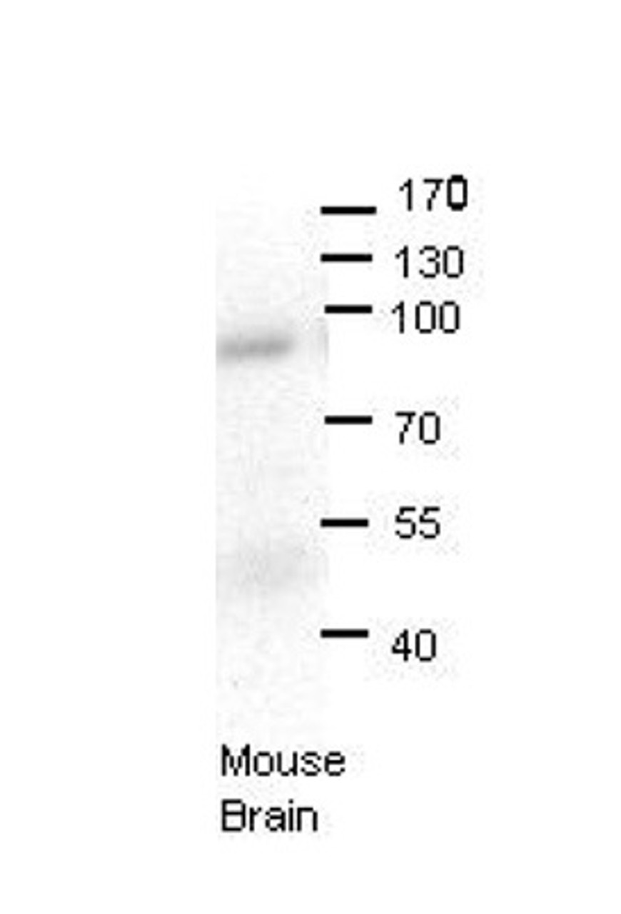 Antibody used in WB on Mouse brains at 1:1000.