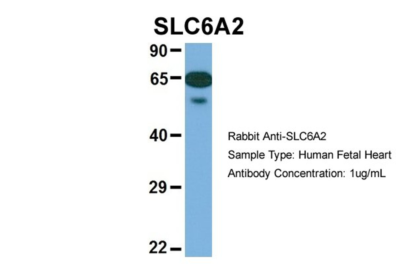 Antibody used in WB on Hum. Fetal Heart at 1 ug/ml.