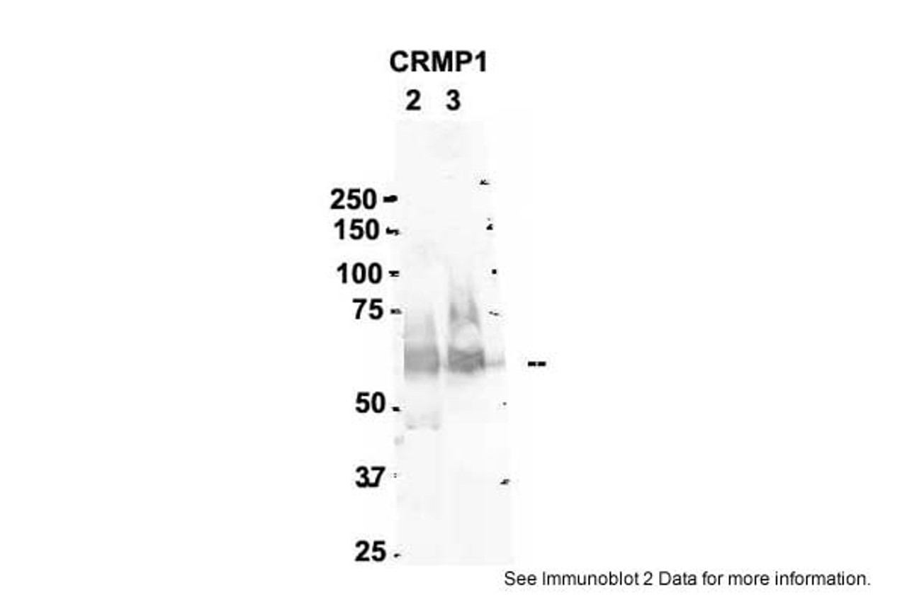 Antibody used in WB on Mouse, Rat 2 ug/ml.