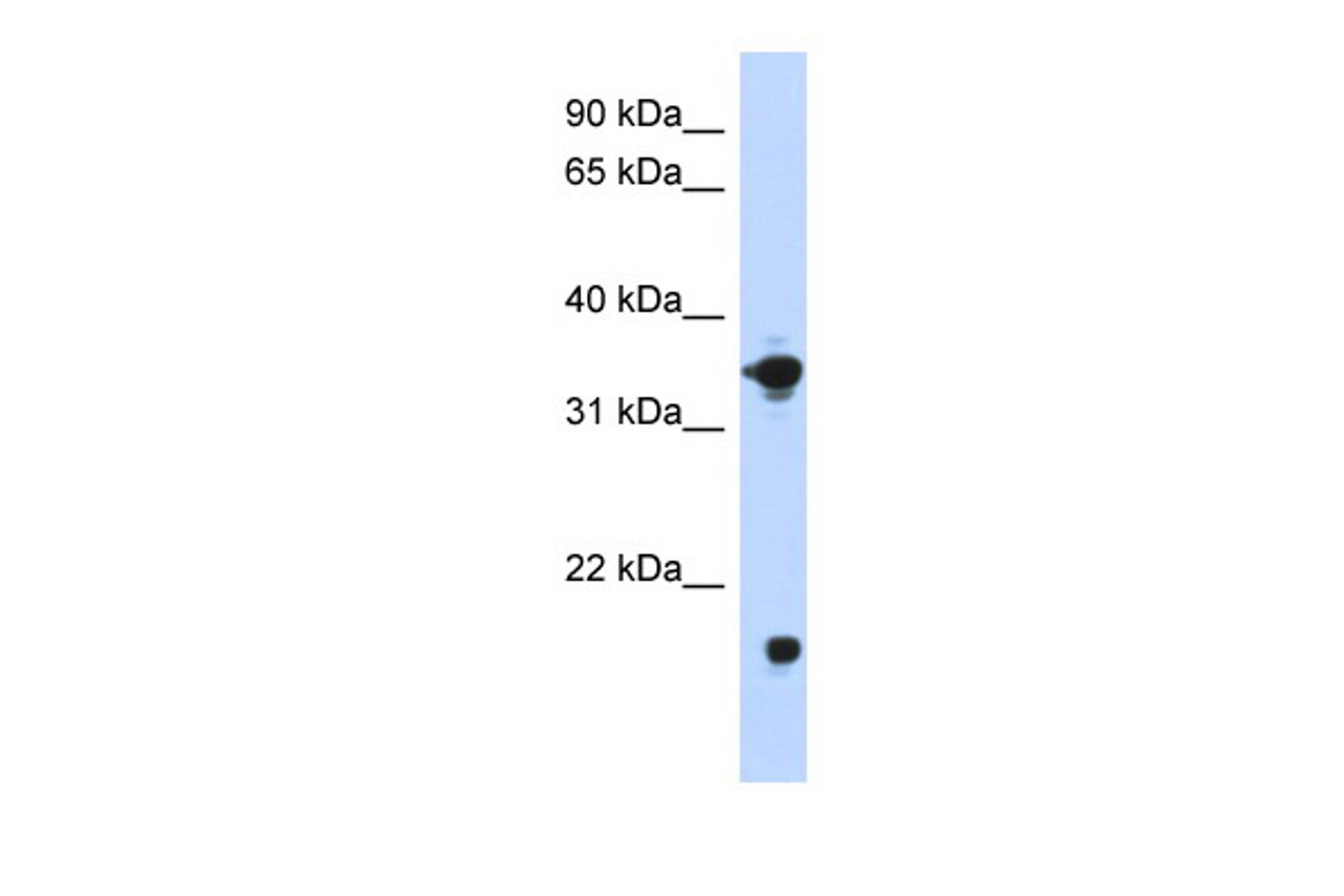 Antibody used in WB on Transfected 293T at 0.2-1 ug/ml.