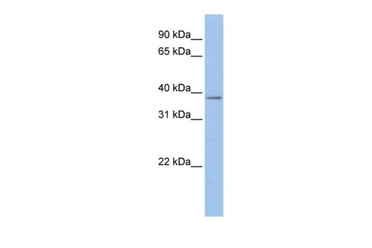 Antibody used in WB on Human MCF-7 at 0.2-1 ug/ml.