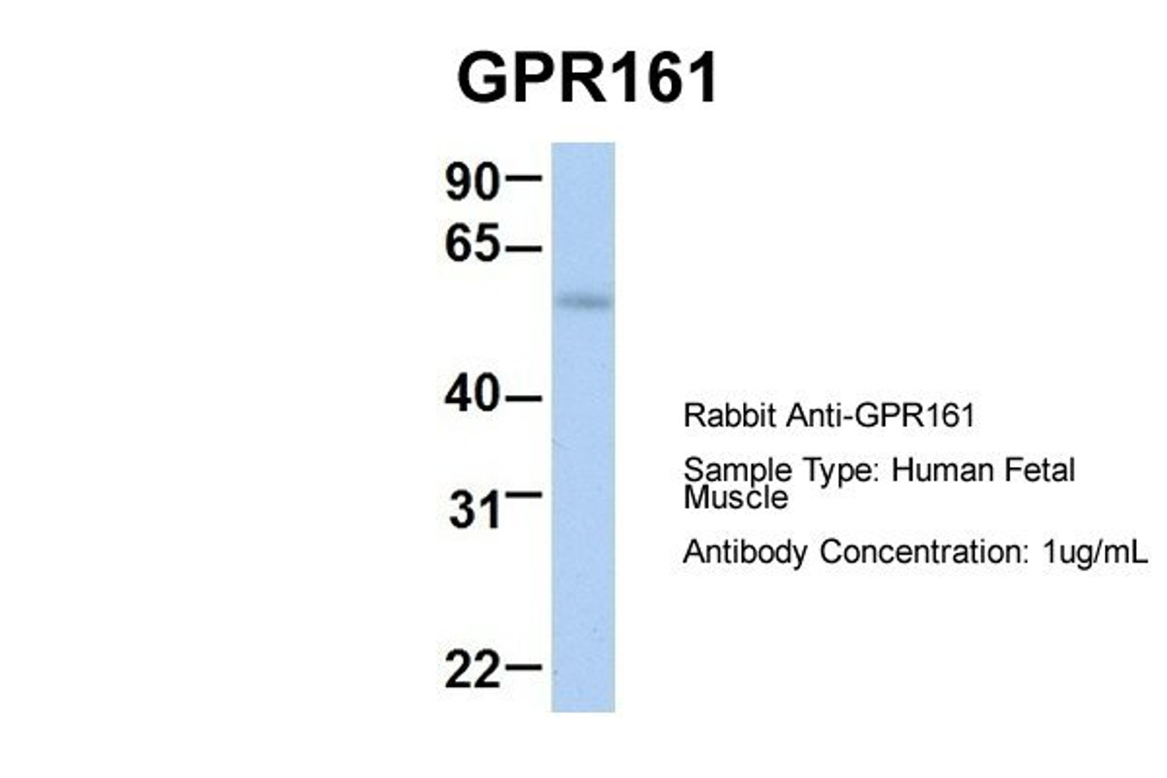 Antibody used in WB on Hum. Fetal Muscle at 1 ug/ml.