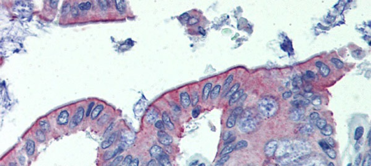 Antibody used in IHC on Human Col.