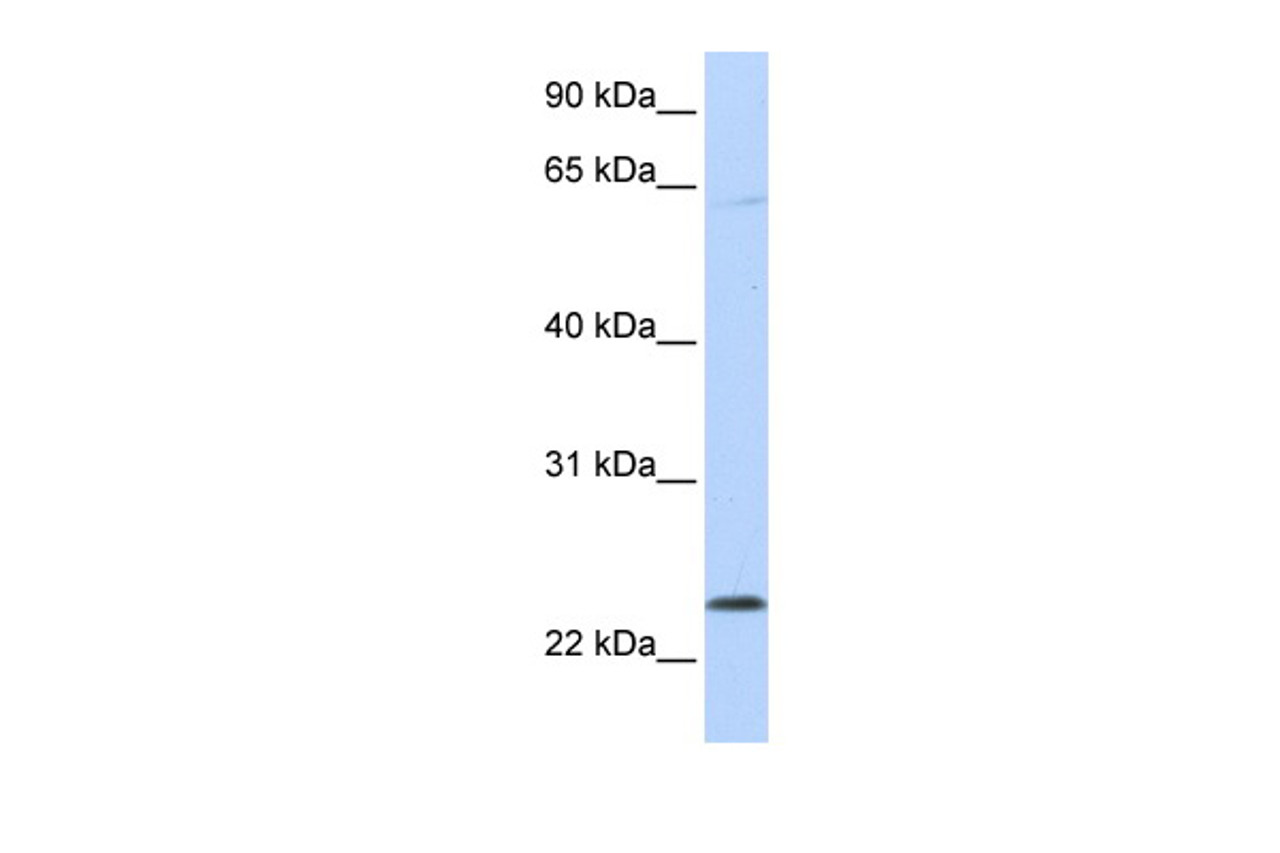 Antibody used in WB on Human 721_B at 0.2-1 ug/ml.