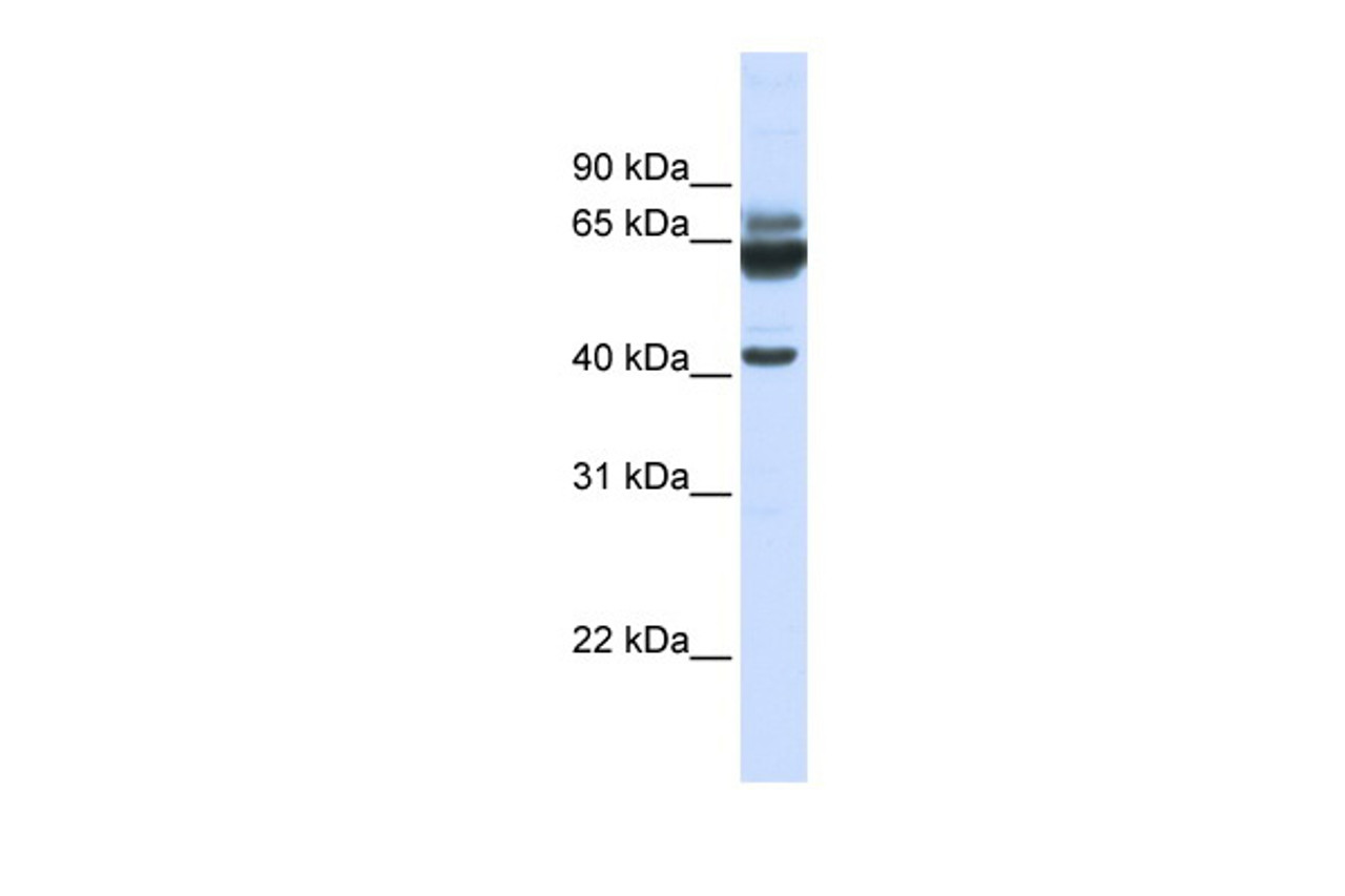 Antibody used in WB on Human 721_B cells at 0.2-1 ug/ml.