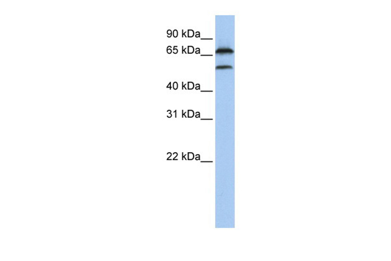 Antibody used in WB on Human MCF7 at 0.2-1 ug/ml.