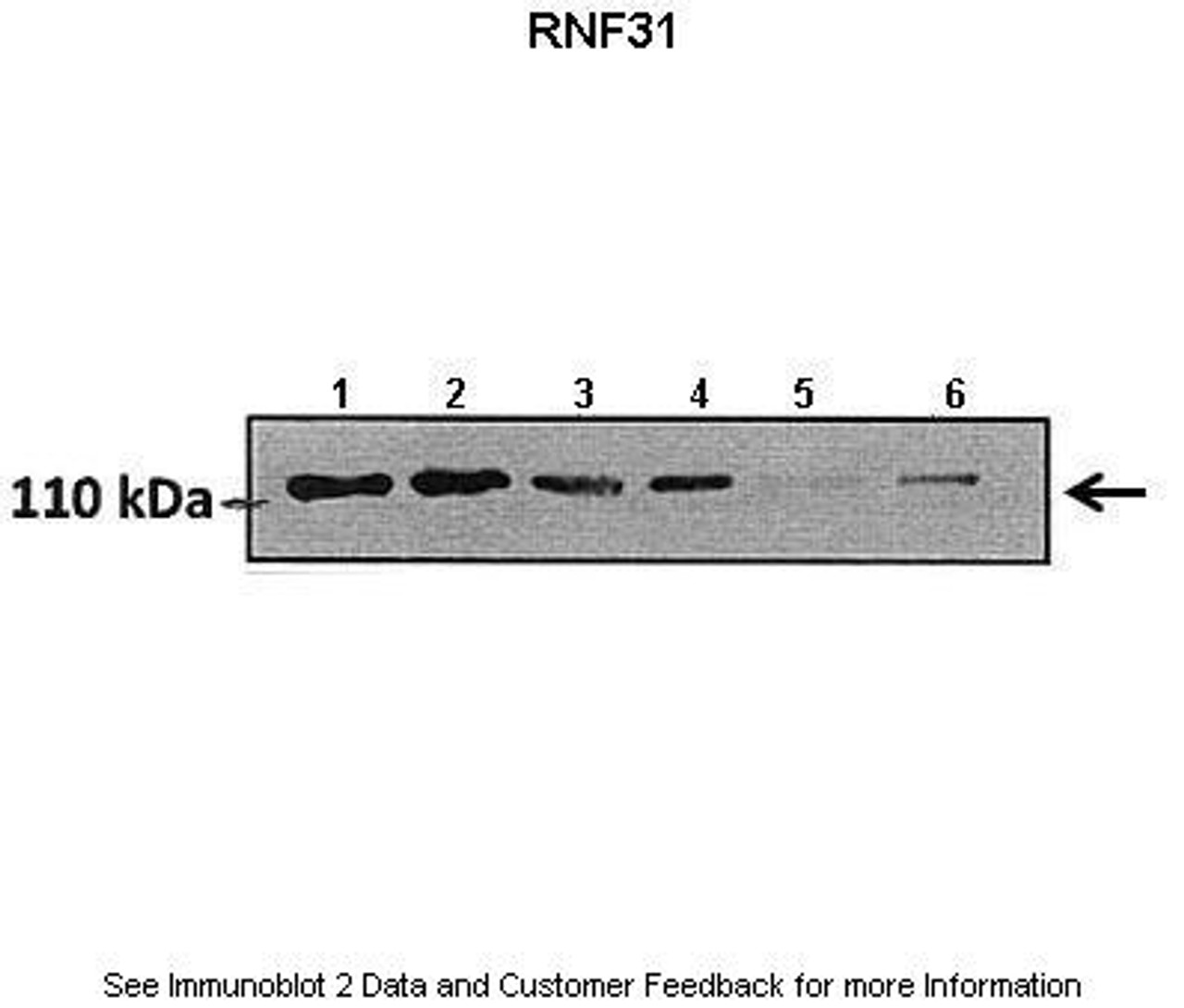 Antibody used in WB on Human A549 at: 1:800 (Lane1: 50 ug hormoxia A549 lysate, Lane2: 50 ug hypoxia A549 lysate, Lane3: 50 ug hormoxia A549 lysate (+scrambled siRNA) , Lane4: 50 ug hypoxia A549 lysate (+scrambled siRNA) , Lane5: 50 ug hormoxia A549 lysate (RNF31 siRNA) , Lane6: 50 ug hypoxia A549 lysate (RNF31 siRNA) ) .