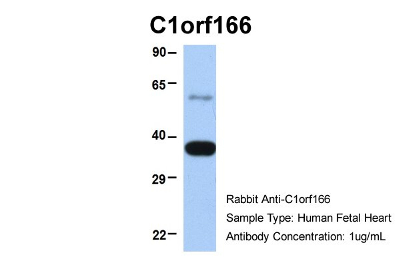 Antibody used in WB on Hum. Fetal Heart at 1 ug/ml.