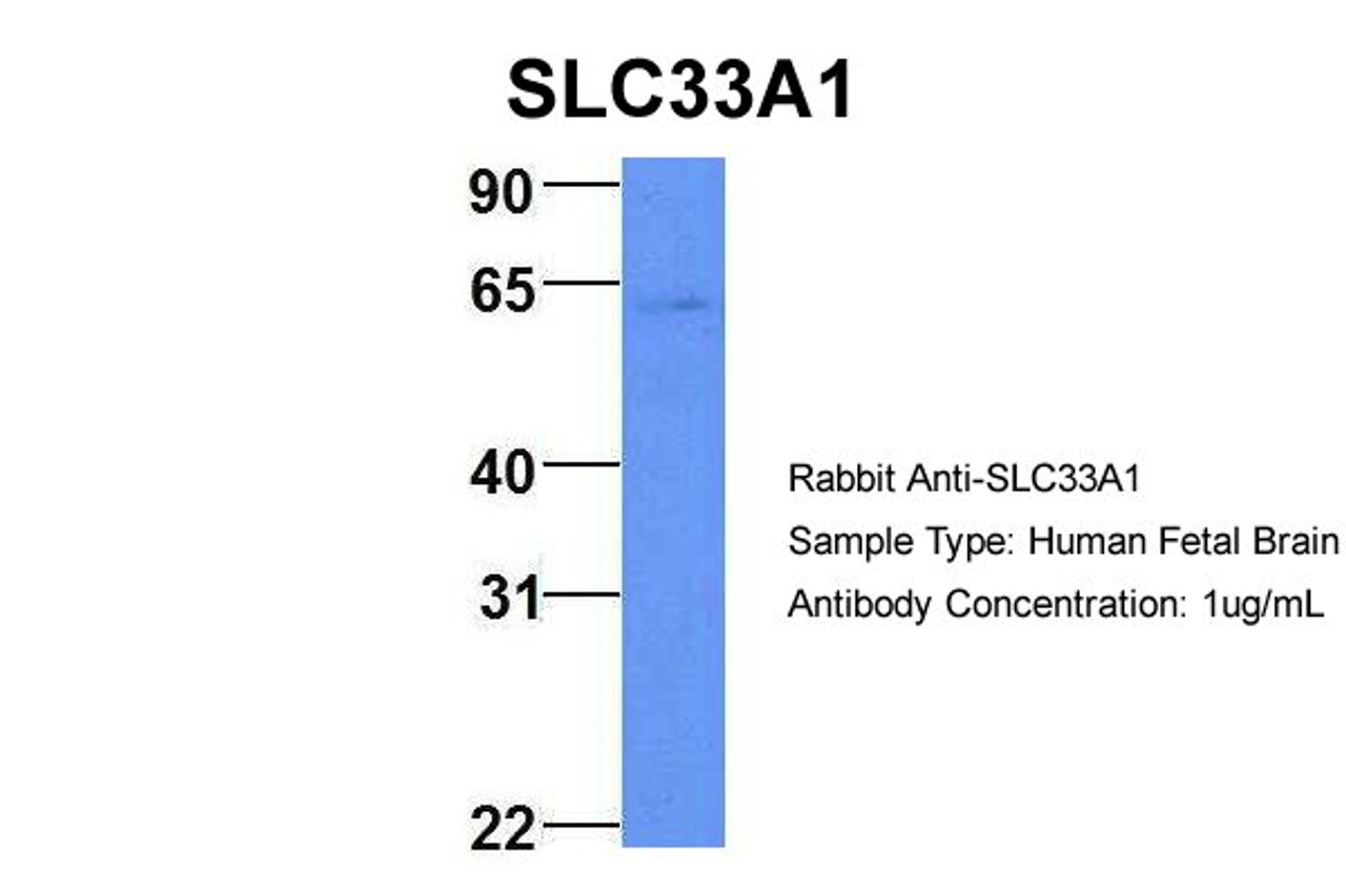 Antibody used in WB on Hum. Fetal Brain at 1 ug/ml.