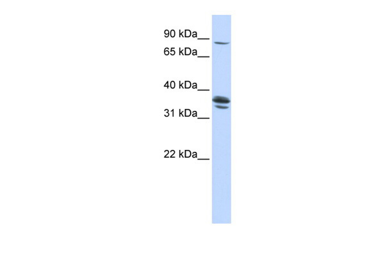 Antibody used in WB on Human 721_B at 0.2-1 ug/ml.