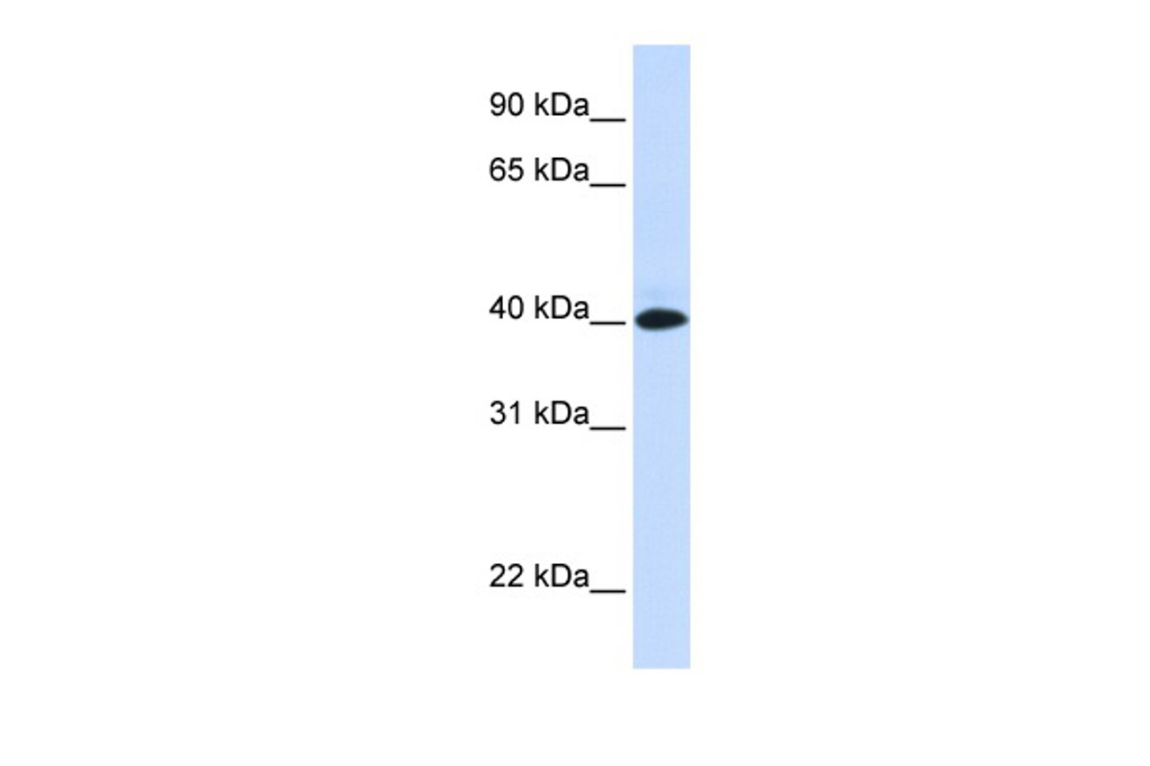 Antibody used in WB on Human Muscle at 0.2-1 ug/ml.