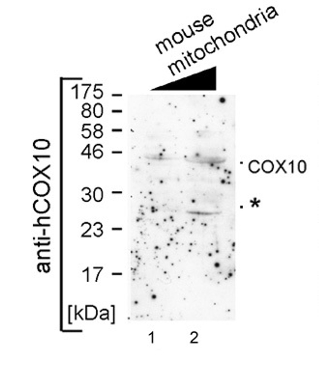 Antibody used in WB on mouse mitochondria at 1:1000.