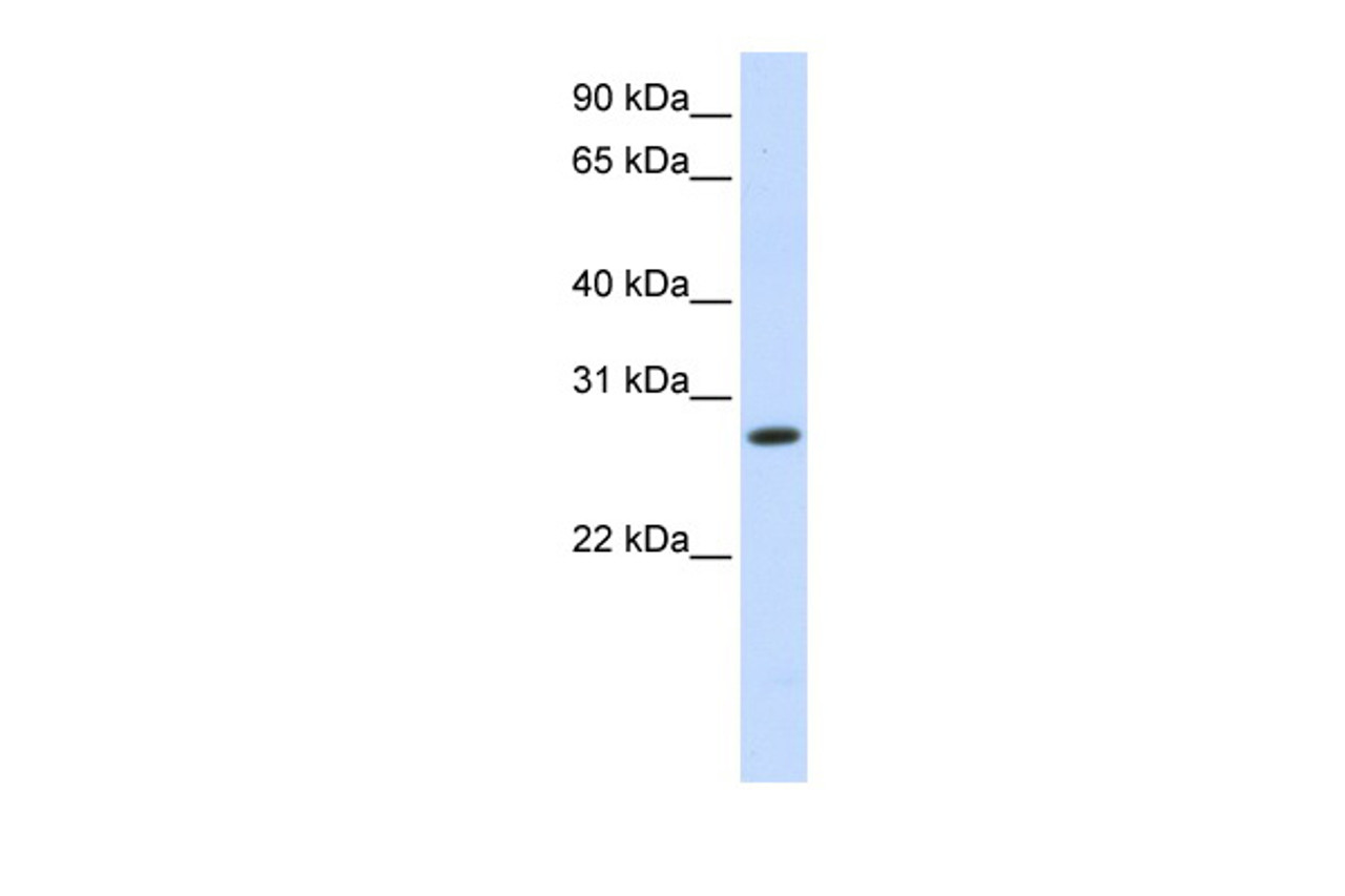 Antibody used in WB on Human Fetal liver at 1 ug/ml.