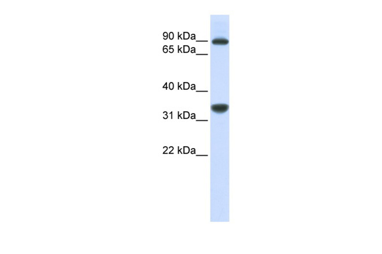 Antibody used in WB on Human MCF7 cells at 0.2-1 ug/ml.