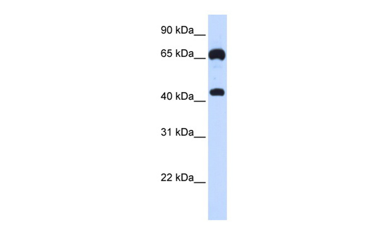Antibody used in WB on Human 293T at 0.2-1 ug/ml.
