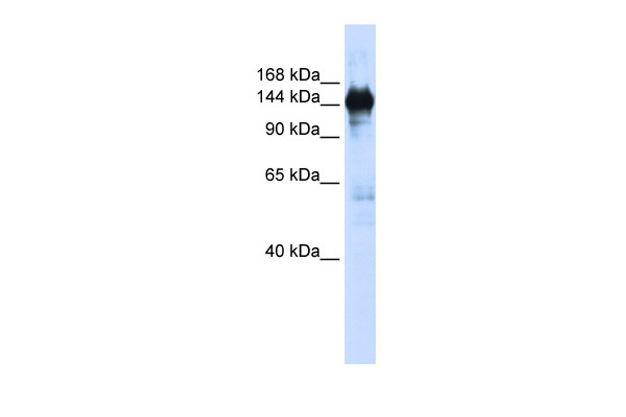 Antibody used in WB on Human 293T at 0.2-1 ug/ml.