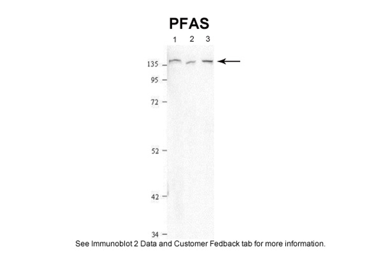 Antibody used in WB on Human cell lines at 1:2000.