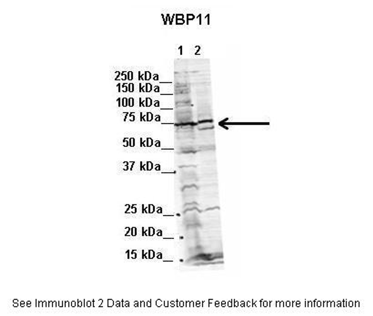 Antibody used in WB on Human, Mouse at 2 ug/ml (Lane 1. Human NT-2 cells (60ug) lysate Lane 2. Mouse WT brain extract (80ug) ) .