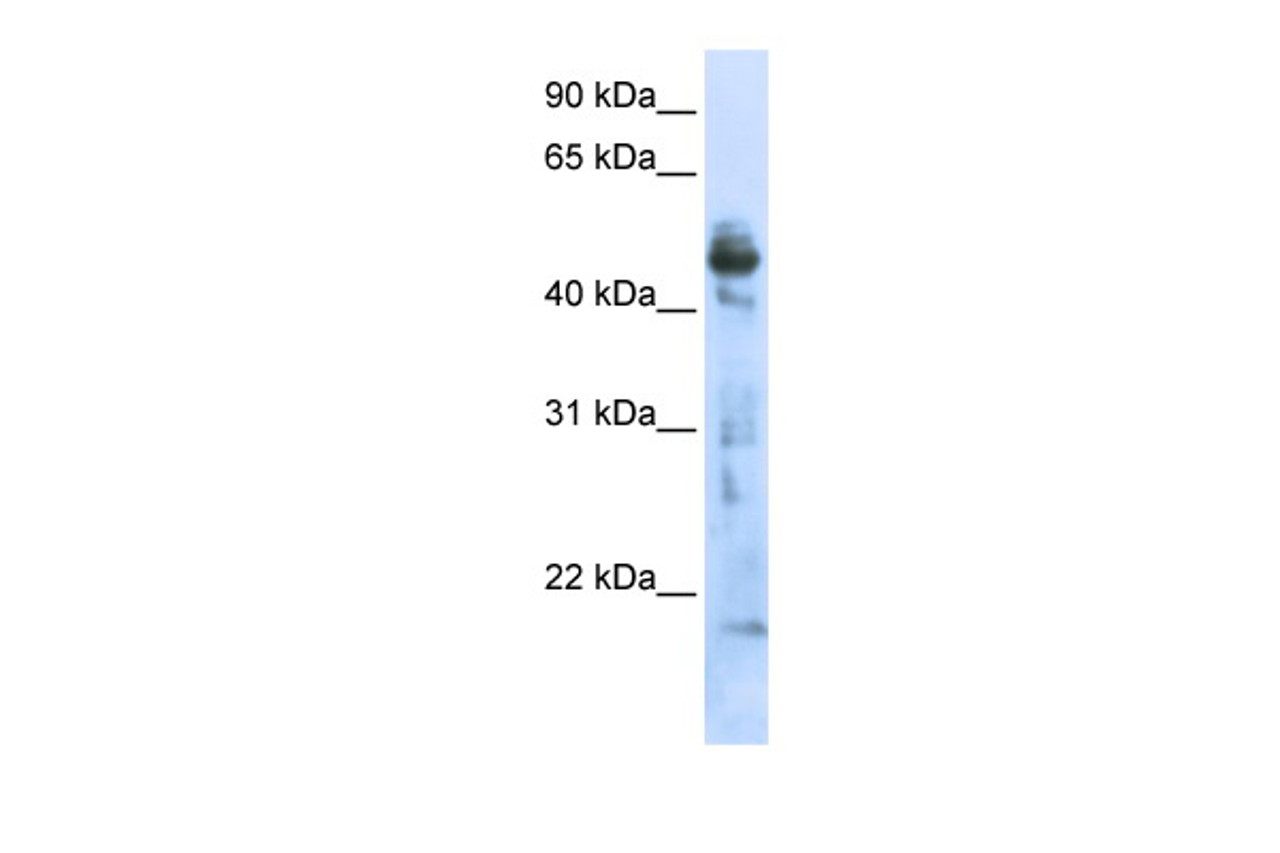 Antibody used in WB on Transfected 293T at 0.2-1 ug/ml.