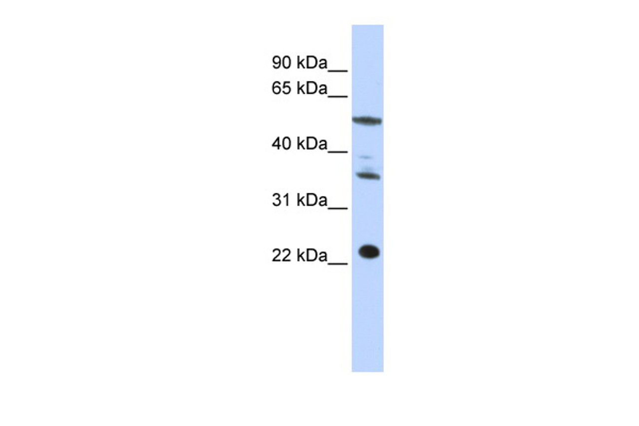 Antibody used in WB on Human HepG2 at 0.2-1 ug/ml.