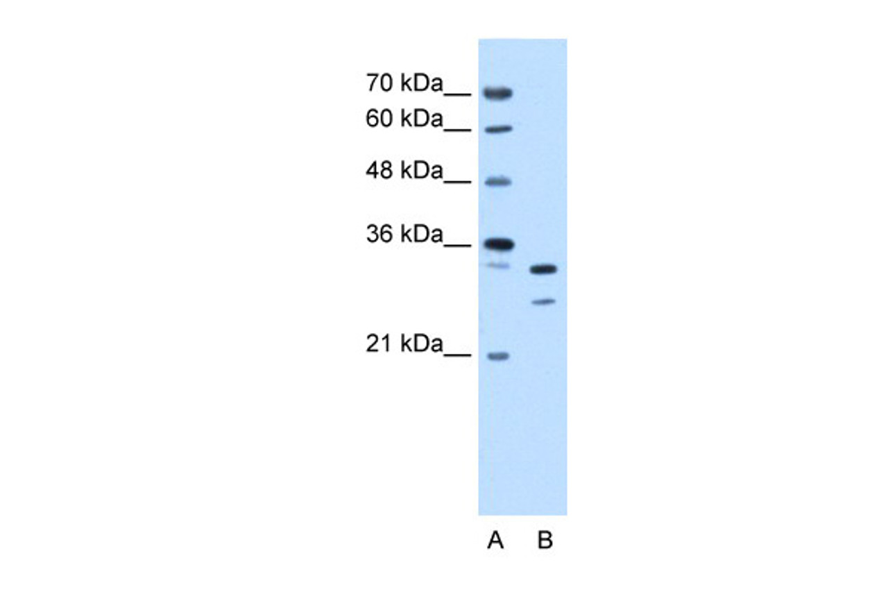 Antibody used in WB on Human HepG2 at 0.25 ug/ml.