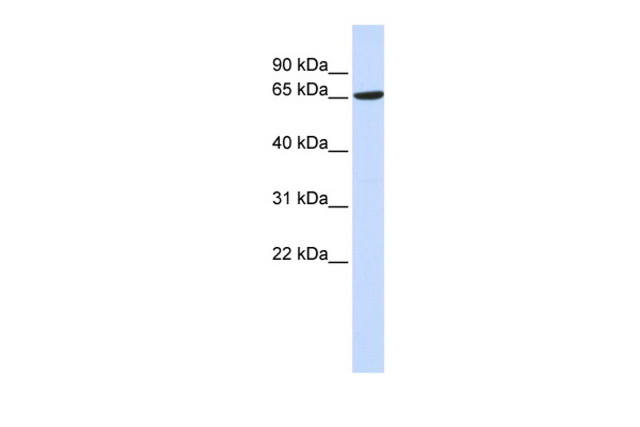 Antibody used in WB on Human 293T at 0.2-1 ug/ml.