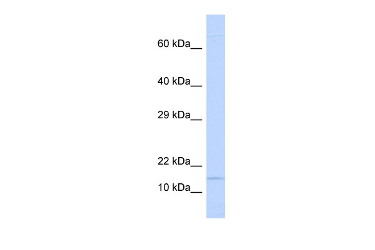 Antibody used in WB on Human Lung at 0.2-1 ug/ml.