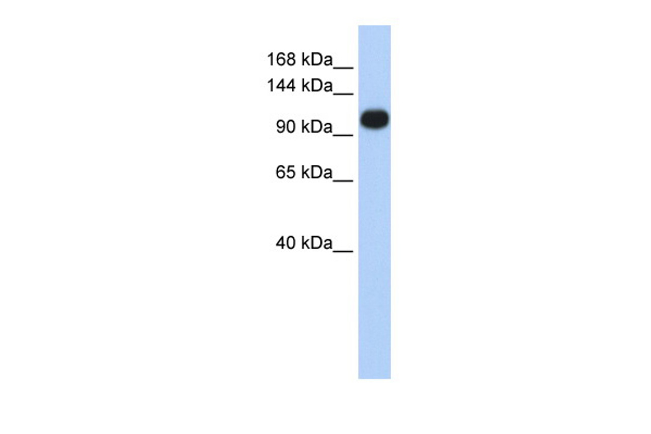 Antibody used in WB on Human Jurkat cells at 0.2-1 ug/ml.