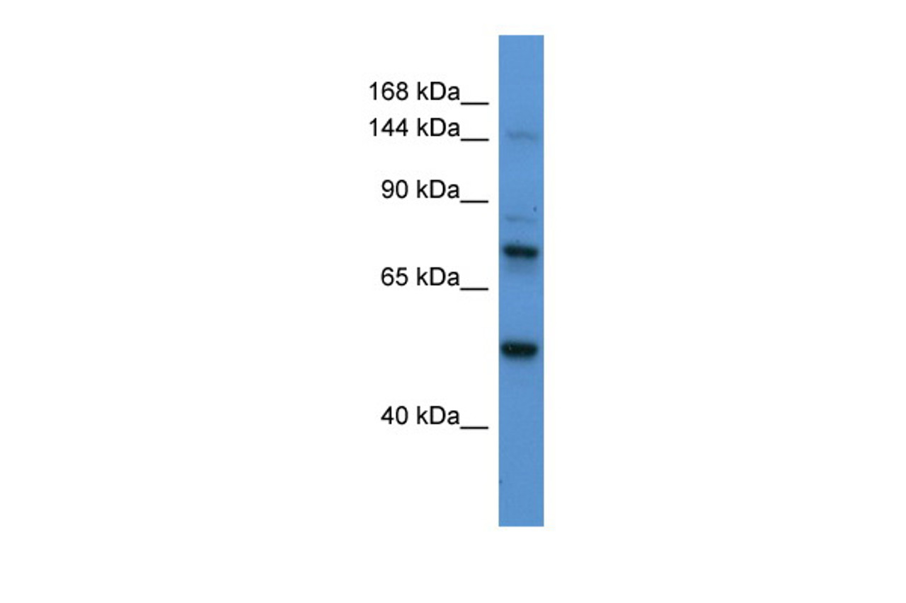 Antibody used in WB on Human Liver at 0.2-1 ug/ml.