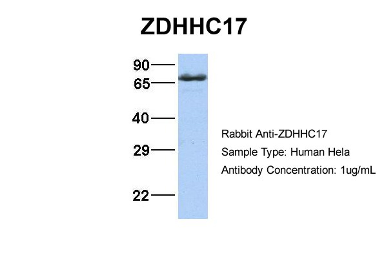 Antibody used in WB on Human Hela at 1 ug/ml.