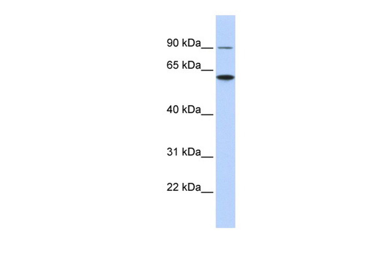 Antibody used in WB on Human HCT15 at 0.2-1 ug/ml.