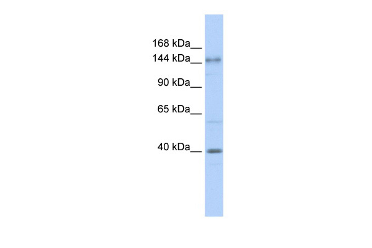 Antibody used in WB on Human Brain at 0.2-1 ug/ml.