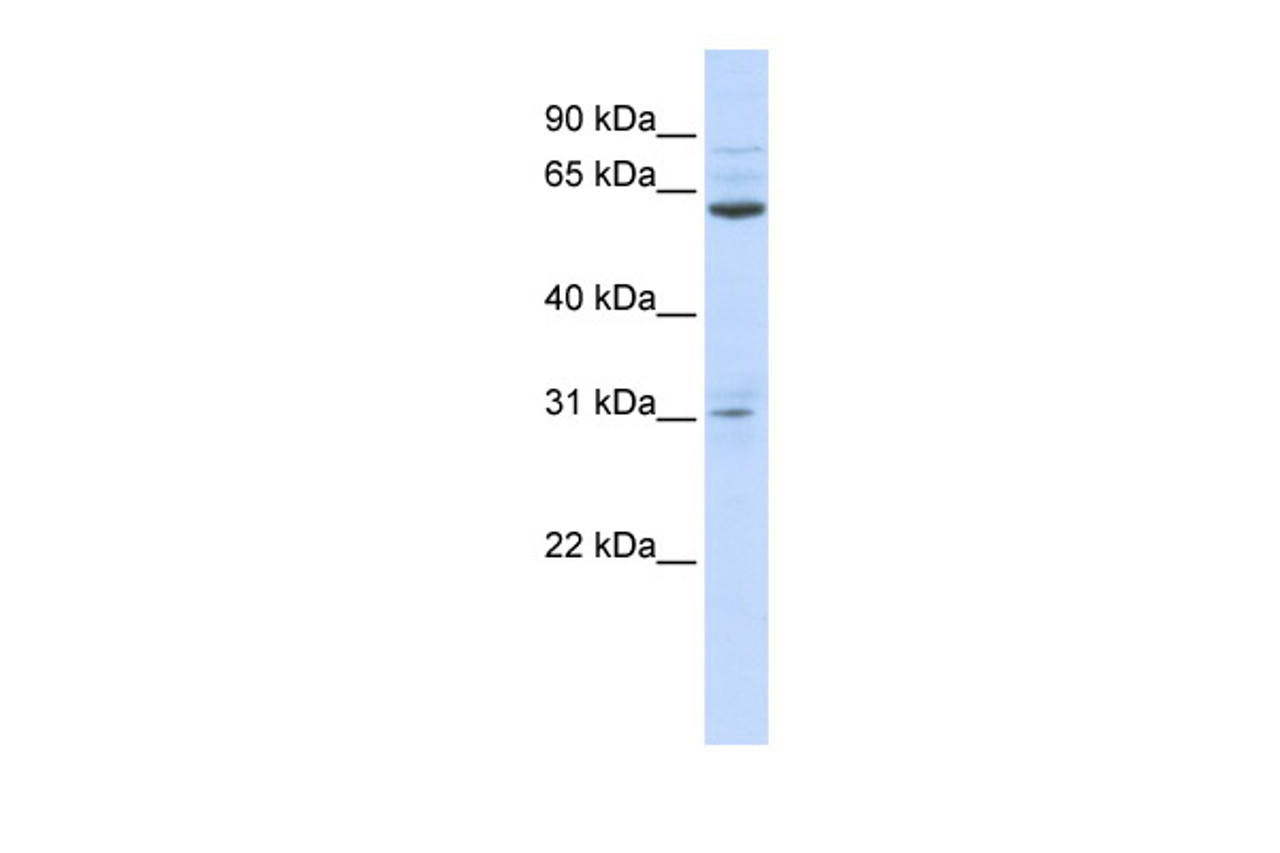 Antibody used in WB on Human 721_B at 0.2-1 ug/ml.