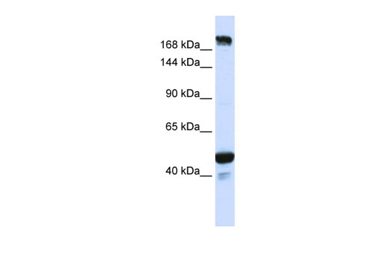 Antibody used in WB on Human Placenta at 0.2-1 ug/ml.