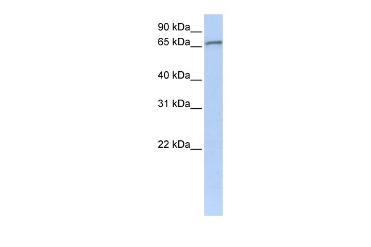 Antibody used in WB on Human Jurkat 0.2-1 ug/ml.