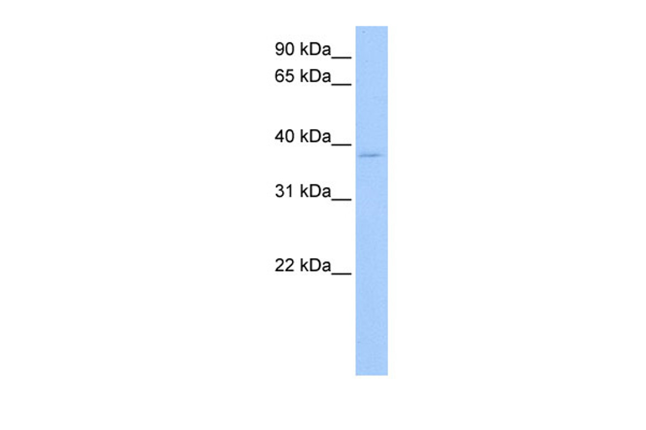 Antibody used in WB on Human 721_B cells at 0.2-1 ug/ml.