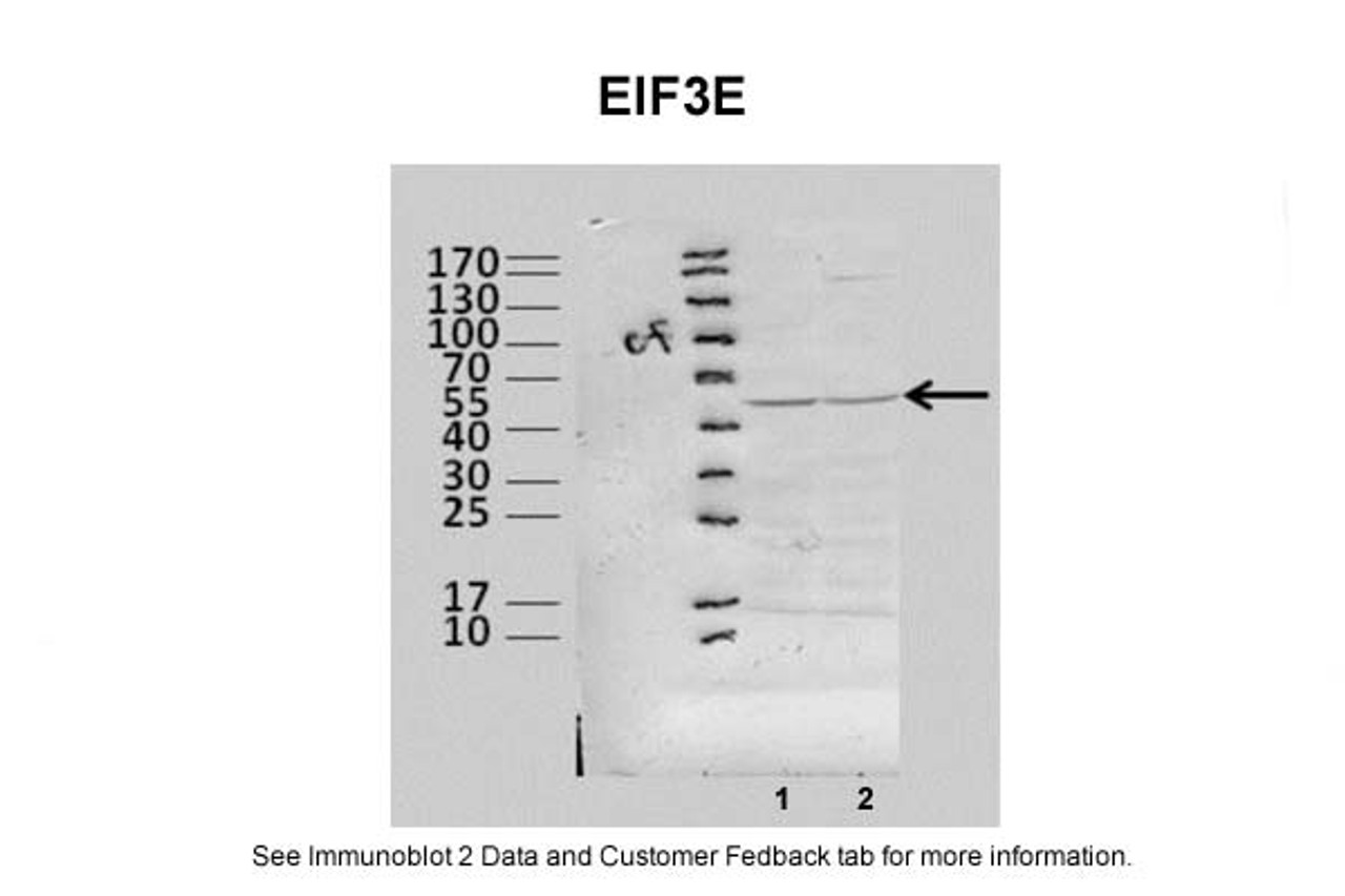 Antibody used in WB on Human, Mouse at 1:1000.