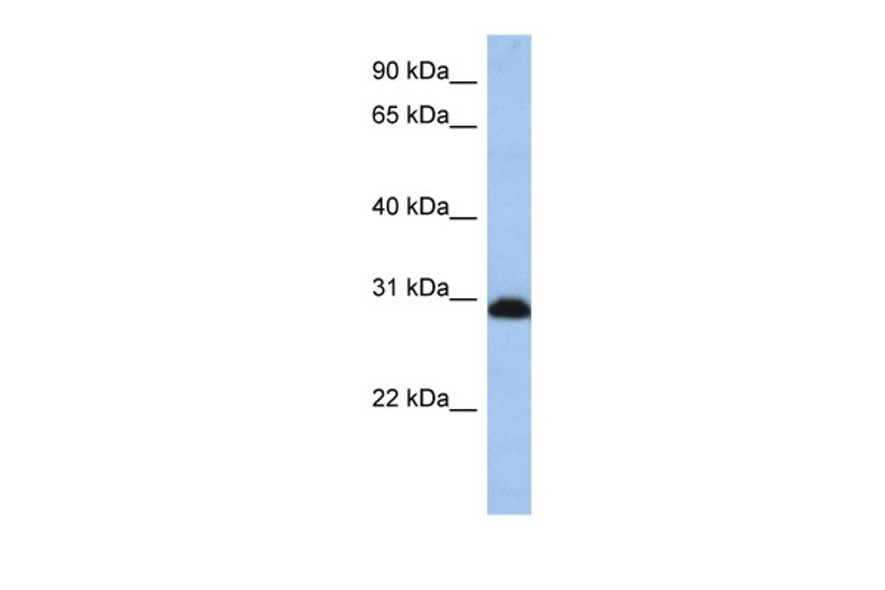 Antibody used in WB on Human HepG2 at 0.2-1 ug/ml.