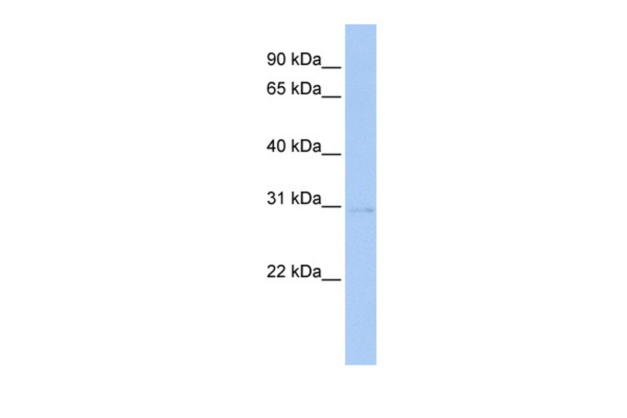 Antibody used in WB on Human brain at 0.2-1 ug/ml.