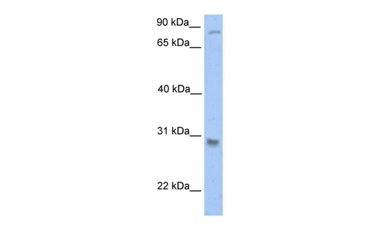 Antibody used in WB on Human Jurkat 0.2-1 ug/ml.