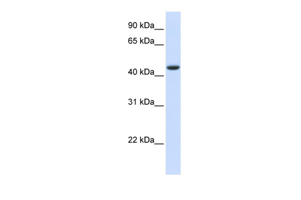 Antibody used in WB on Human Muscle at 0.2-1 ug/ml.