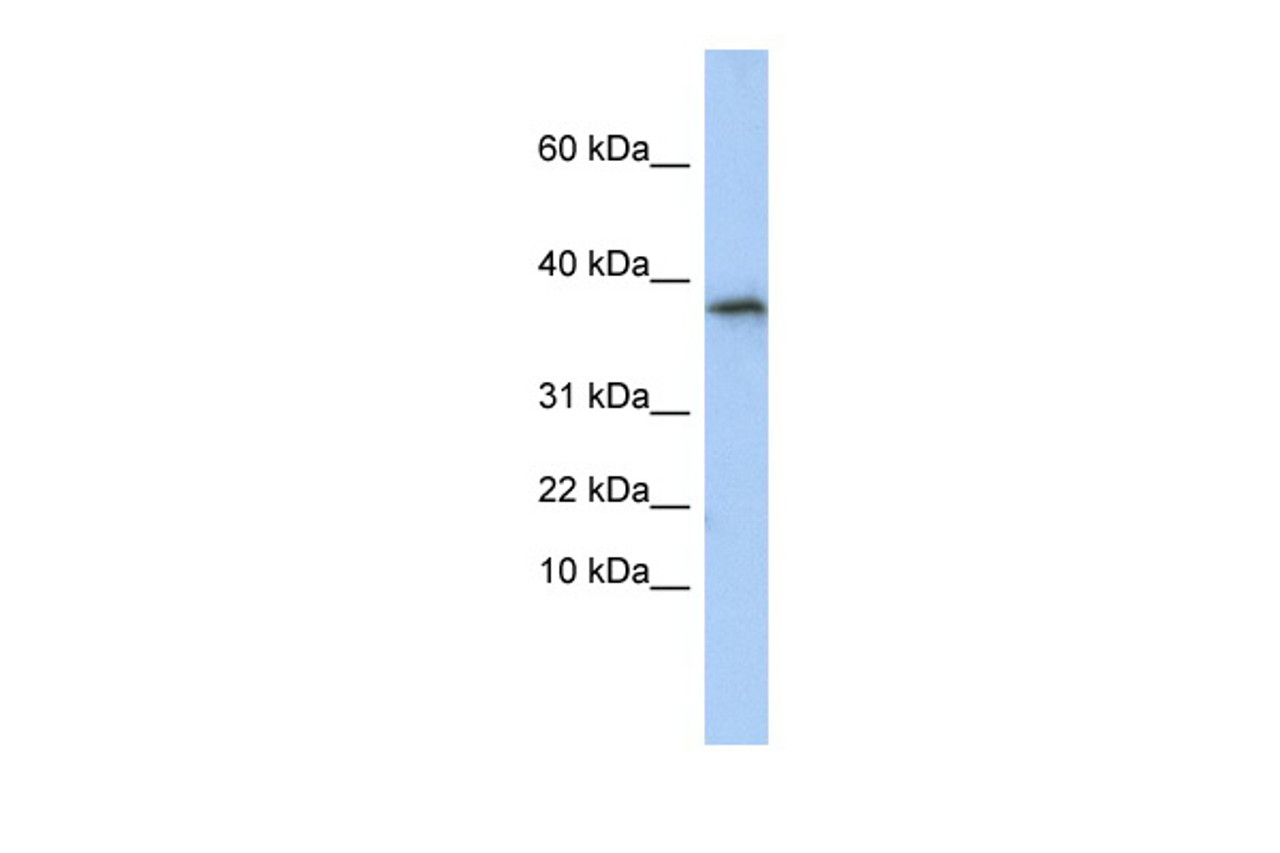 Antibody used in WB on Human HepG2 at 0.2-1 ug/ml.