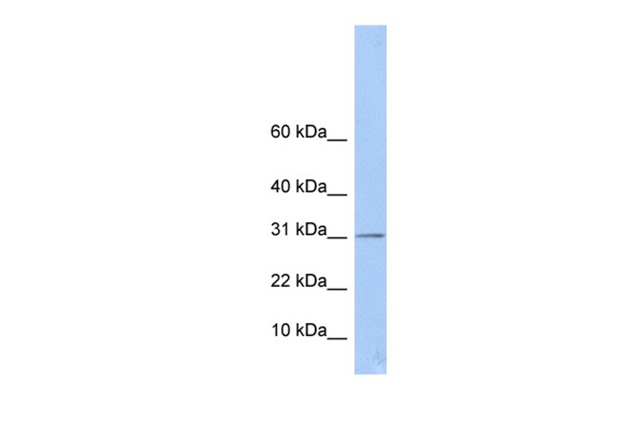 Antibody used in WB on Human MCF-7 at 0.2-1 ug/ml.