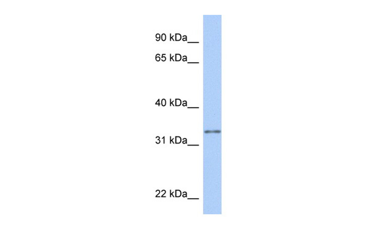 Antibody used in WB on Human HeLa at 0.2-1 ug/ml.