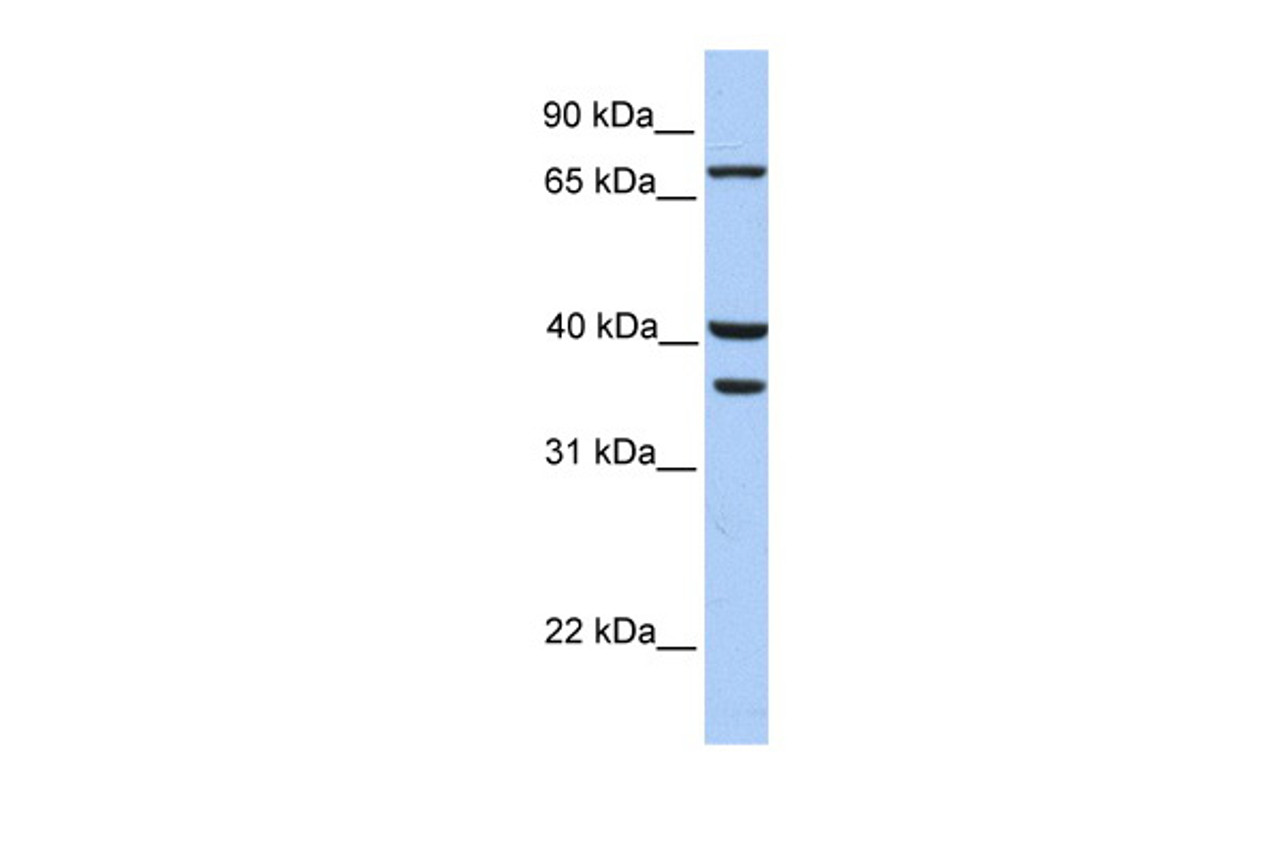 Antibody used in WB on Human HeLa at 0.2-1 ug/ml.